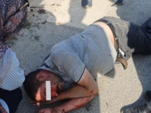 Motosiklet Yayaya Çarptı: Yaralı Hastaneye Kaldırıldı